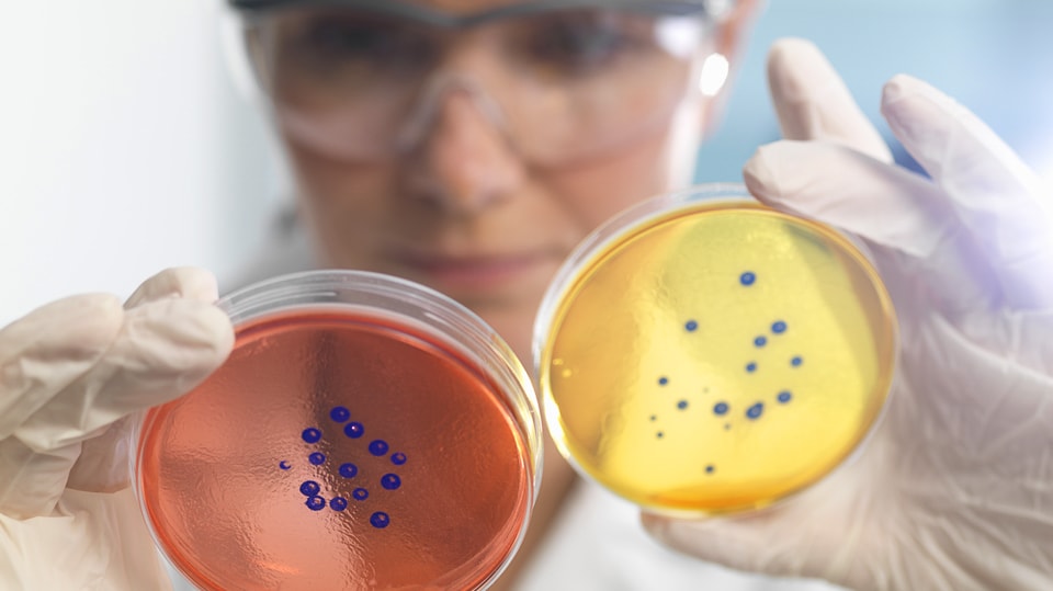 A scientist is examining two colourful petri dish specimens.