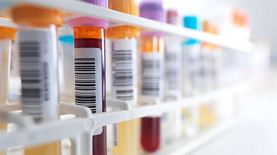 A line of blood samples ready for genetic testing.