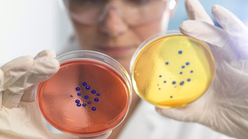 Researcher looking at a petri dish