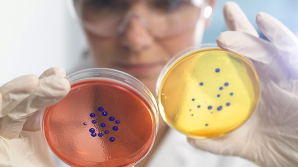 A researcher examining petri dish specimens.